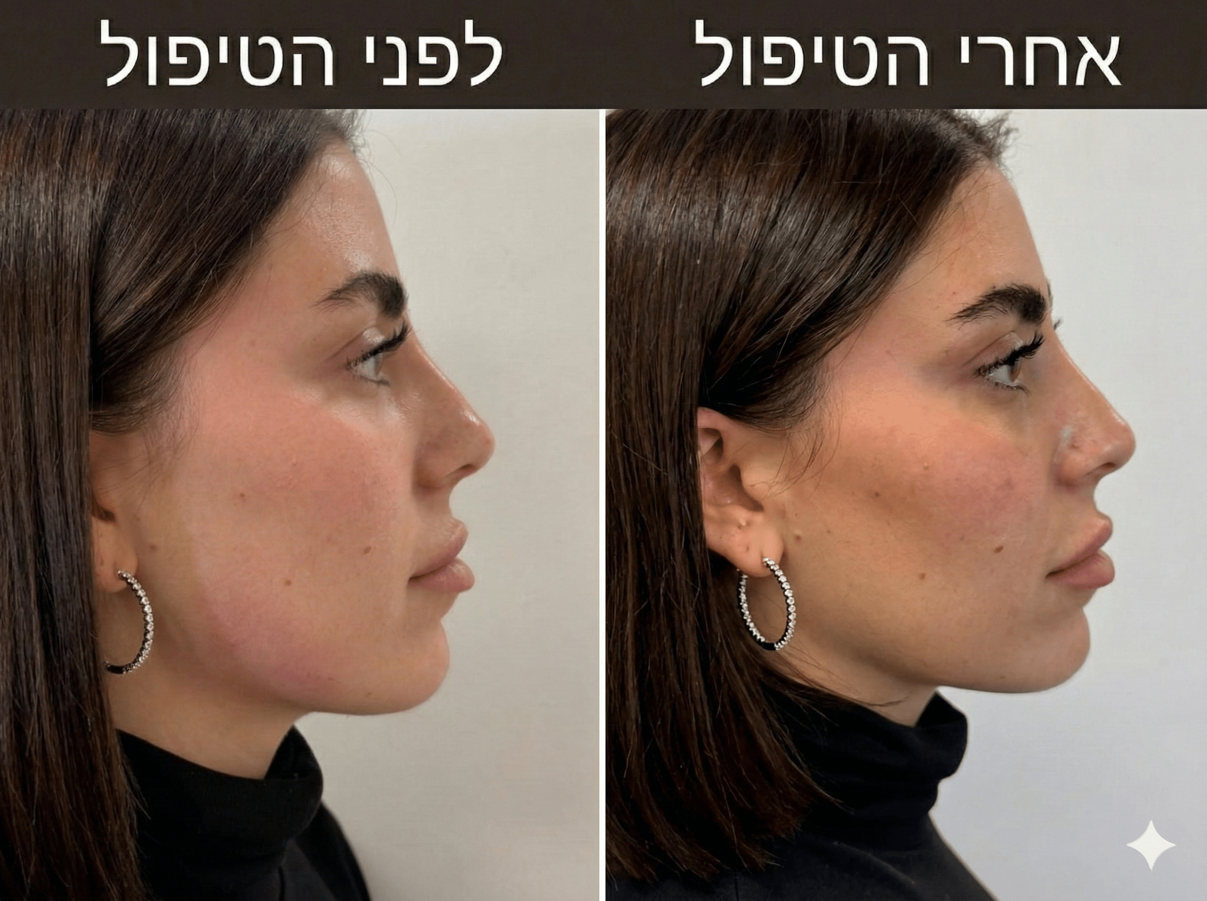 פיסול פנים