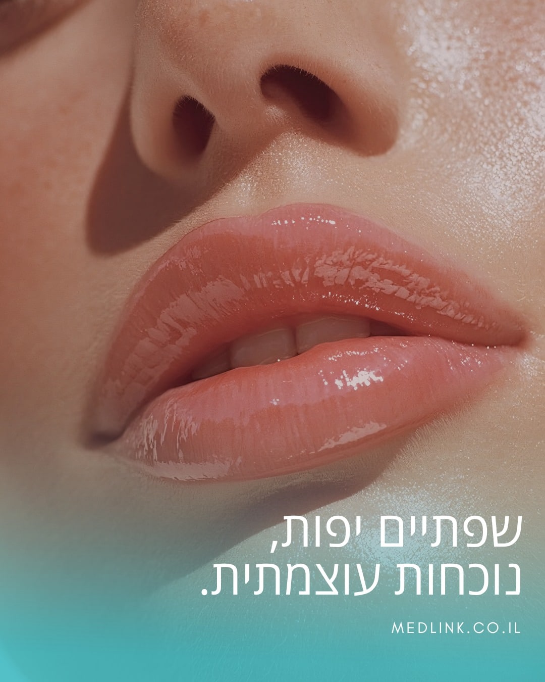 שפתיים מלאות